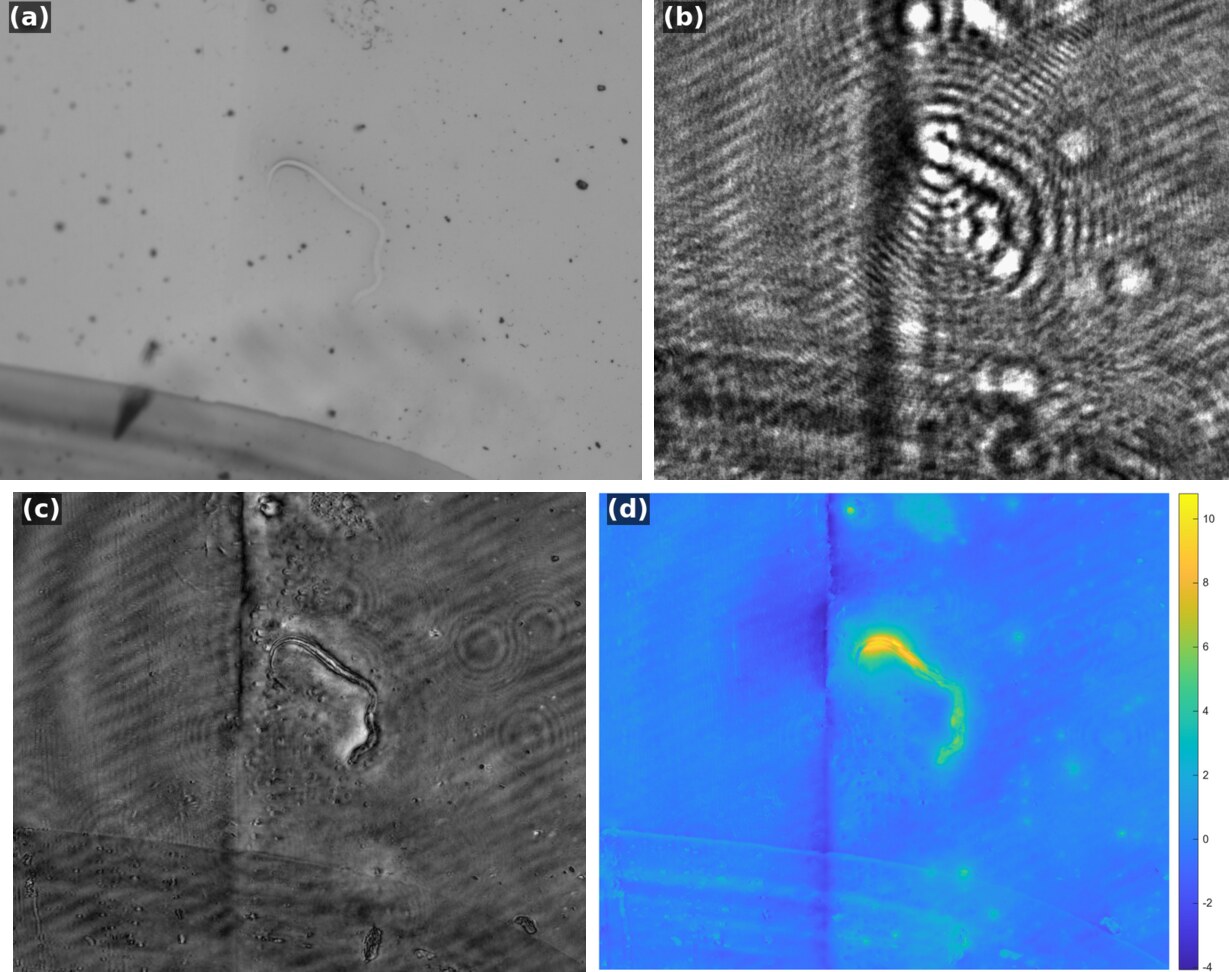 Microfilaria: bright-field image with a 10x objective, recorded lensless hologram, reconstructed amplitude, and phase map.