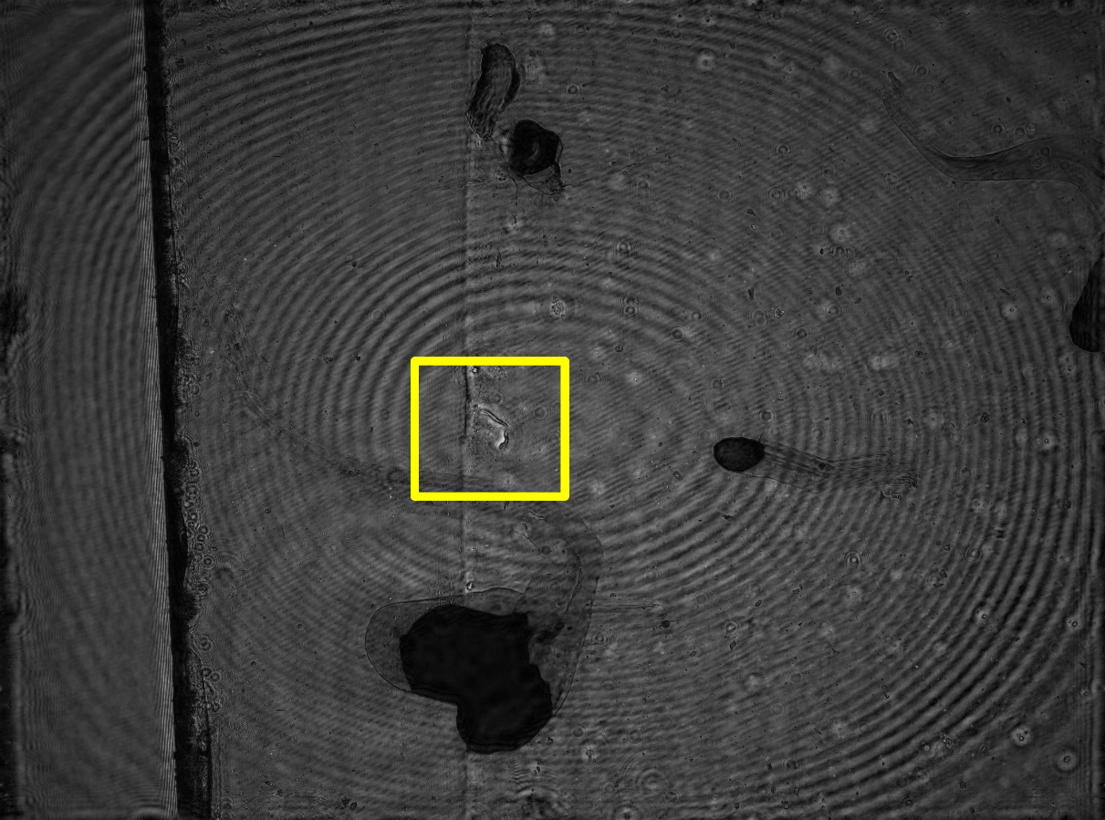 Large field-of-view lensless image of the microfilaria sample with a yellow rectangle marking the field of view of a 10x objective.