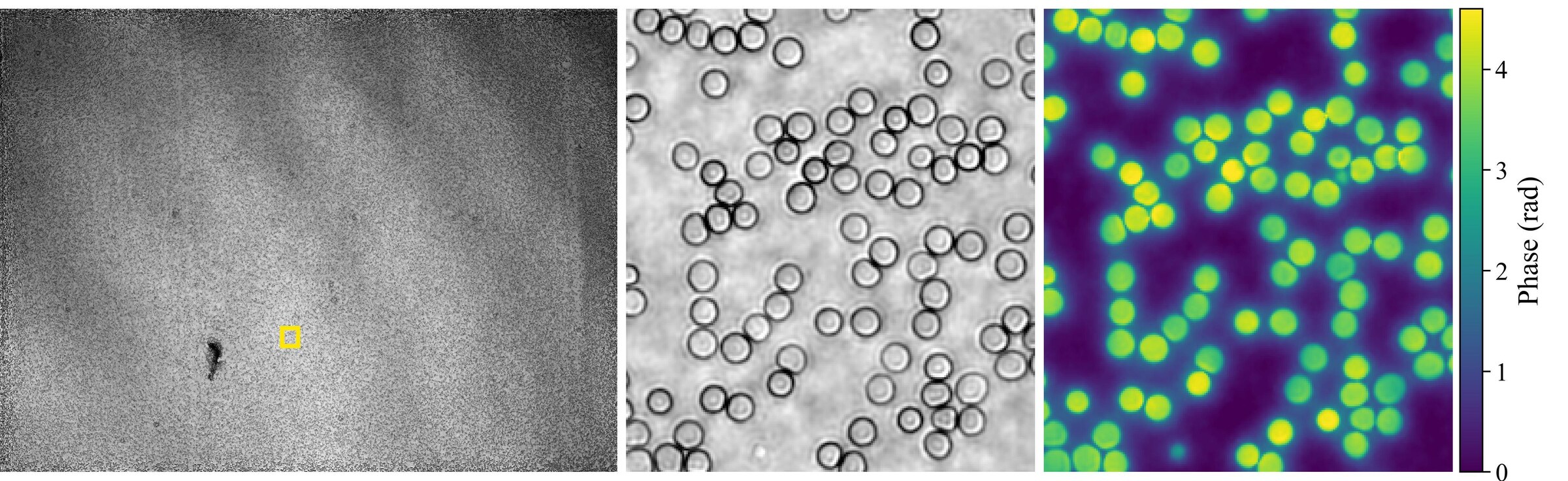 Reconstructed absorption map of a blood smear with an enlarged region, and the reconstructed phase map of red blood cells.